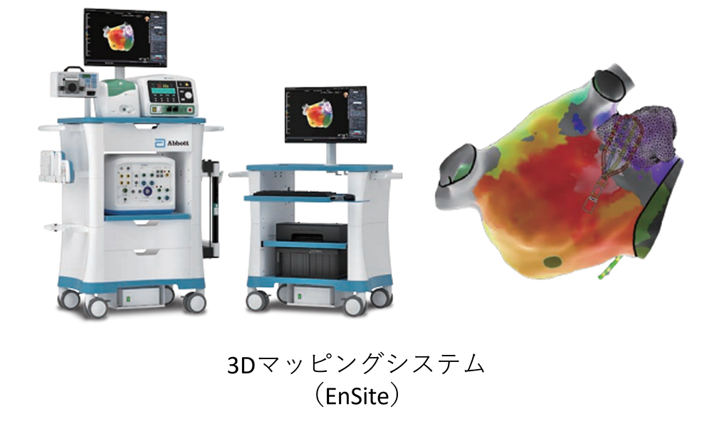 3Dマッピングシステム （EnSite）